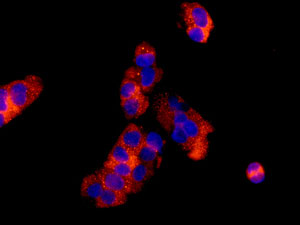Immunocytochemistry/ Immunofluorescence - Anti-RPL30 antibody [EPR11624] (AB170930)