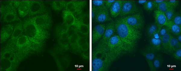 Immunocytochemistry/ Immunofluorescence - Anti-RPL32 antibody (AB229758), expandable thumbnail