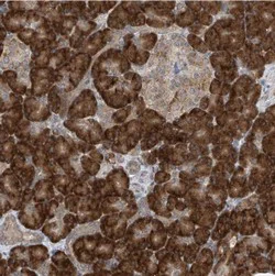 Immunohistochemistry (Formalin/PFA-fixed paraffin-embedded sections) - Anti-RPL34 antibody (AB122255)