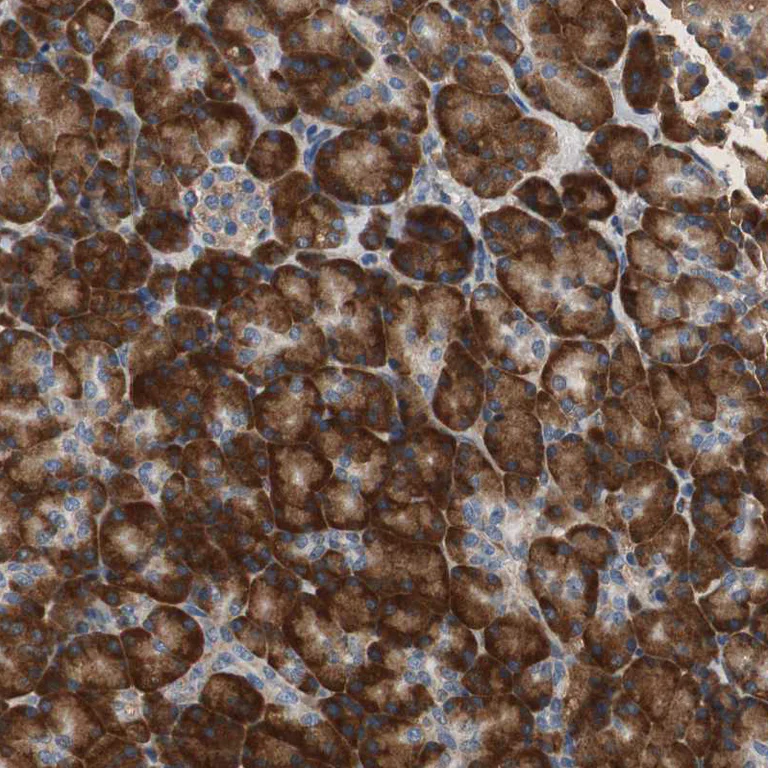 Immunohistochemistry (Formalin/PFA-fixed paraffin-embedded sections) - Anti-RPL35 antibody (AB121244)