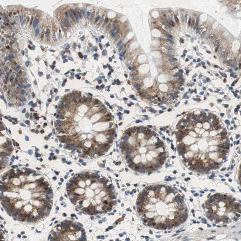 Immunohistochemistry (Formalin/PFA-fixed paraffin-embedded sections) - Anti-RPL35 antibody (AB121244)