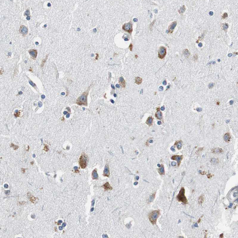 Immunohistochemistry (Formalin/PFA-fixed paraffin-embedded sections) - Anti-RPL35 antibody (AB121244)