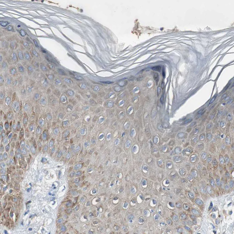 Immunohistochemistry (Formalin/PFA-fixed paraffin-embedded sections) - Anti-RPL35 antibody (AB121244)