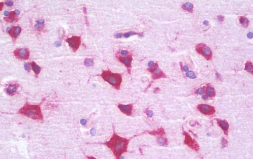 Immunohistochemistry (Formalin/PFA-fixed paraffin-embedded sections) - Anti-RPL35 antibody (AB190162)