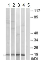 Western blot - Anti-RPL35 antibody (AB190162)