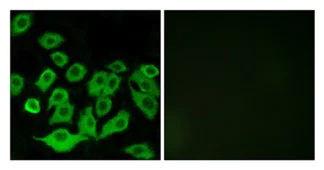 Immunocytochemistry/ Immunofluorescence - Anti-RPL36 antibody (AB196734)