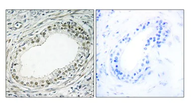 Immunohistochemistry (Formalin/PFA-fixed paraffin-embedded sections) - Anti-RPL36 antibody (AB196734)