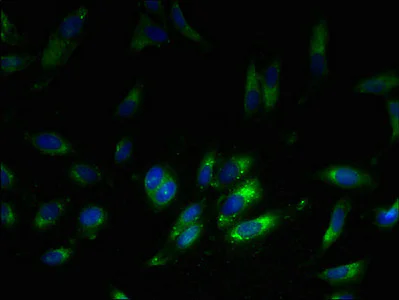 Immunocytochemistry/ Immunofluorescence - Anti-RPL38 antibody (AB236880)