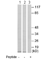 Western blot - Anti-RPL39 antibody (AB74740), expandable thumbnail