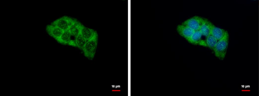 Immunocytochemistry - Anti-RPL4 antibody (AB154907), expandable thumbnail