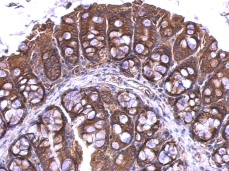 Immunohistochemistry (Formalin/PFA-fixed paraffin-embedded sections) - Anti-RPL4 antibody (AB154907)