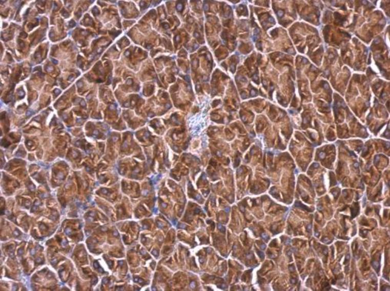 Immunohistochemistry (Formalin/PFA-fixed paraffin-embedded sections) - Anti-RPL4 antibody (AB154907), expandable thumbnail