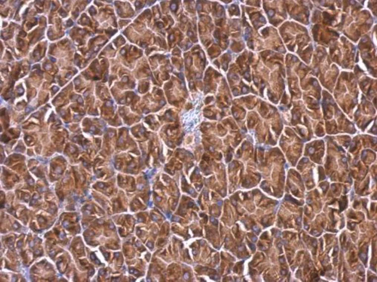 Immunohistochemistry (Formalin/PFA-fixed paraffin-embedded sections) - Anti-RPL4 antibody (AB154907)