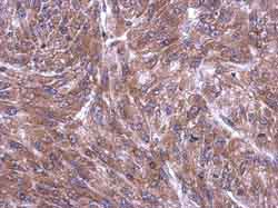 Immunohistochemistry (Formalin/PFA-fixed paraffin-embedded sections) - Anti-RPL4 antibody (AB154907), expandable thumbnail