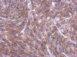 Immunohistochemistry (Formalin/PFA-fixed paraffin-embedded sections) - Anti-RPL4 antibody (AB154907)