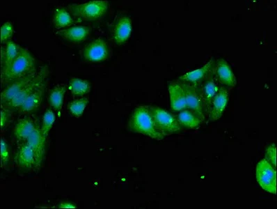 Immunocytochemistry/ Immunofluorescence - Anti-RPL4 antibody (AB234829)