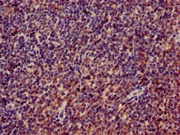 Immunohistochemistry (Formalin/PFA-fixed paraffin-embedded sections) - Anti-RPL4 antibody (AB234829)
