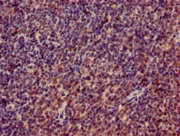 Immunohistochemistry (Formalin/PFA-fixed paraffin-embedded sections) - Anti-RPL4 antibody (AB234829)