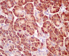 Immunohistochemistry (Formalin/PFA-fixed paraffin-embedded sections) - Anti-RPL4 antibody [EPR12304] (AB174269)