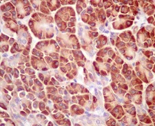 Immunohistochemistry (Formalin/PFA-fixed paraffin-embedded sections) - Anti-RPL4 antibody [EPR12304] - BSA and Azide free (AB249780)