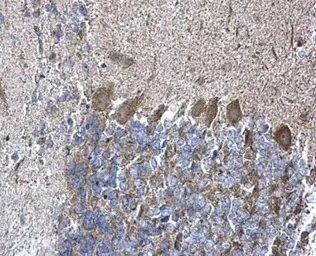 Immunohistochemistry (Formalin/PFA-fixed paraffin-embedded sections) - Anti-RPL5 antibody (AB137617)
