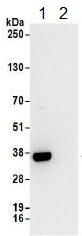 Immunoprecipitation - Anti-RPL5 antibody (AB157099), expandable thumbnail