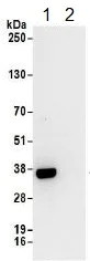Immunoprecipitation - Anti-RPL5 antibody (AB157099)