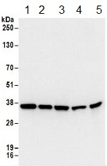 Western blot - Anti-RPL5 antibody (AB157099), expandable thumbnail
