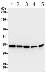 Western blot - Anti-RPL5 antibody (AB157099)