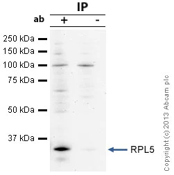 Immunoprecipitation - Anti-RPL5 antibody (AB86863)