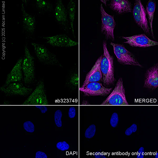 Immunocytochemistry/ Immunofluorescence - Anti-RPL5 antibody [EPR29623-506] - BSA and Azide free (AB323765)