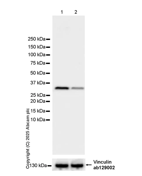 Western blot - Anti-RPL5 antibody [EPR29623-506] - BSA and Azide free (AB323765)