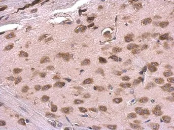 Immunohistochemistry (Formalin/PFA-fixed paraffin-embedded sections) - Anti-RPL6 antibody (AB126100)