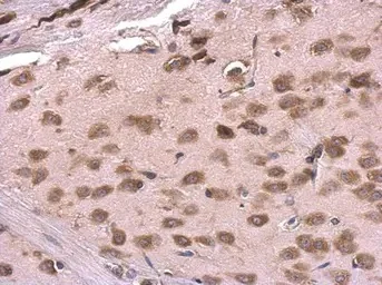Immunohistochemistry (Formalin/PFA-fixed paraffin-embedded sections) - Anti-RPL6 antibody (AB126100)