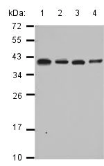 Western blot - Anti-RPL6 antibody (AB126100)
