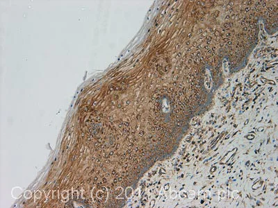 Immunohistochemistry (Formalin/PFA-fixed paraffin-embedded sections) - Anti-RPL7 antibody (AB72550)