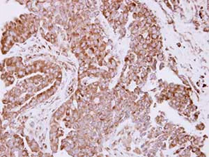 Immunohistochemistry (Formalin/PFA-fixed paraffin-embedded sections) - Anti-RPL7A antibody (AB155147)