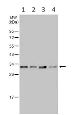 Western blot - Anti-RPL7A antibody (AB155147)