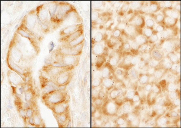 Immunohistochemistry (Formalin/PFA-fixed paraffin-embedded sections) - Anti-RPL7A antibody (AB70753)