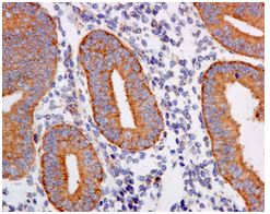 Immunohistochemistry (Formalin/PFA-fixed paraffin-embedded sections) - Anti-RPL7A antibody [EPR12310] (AB172478)