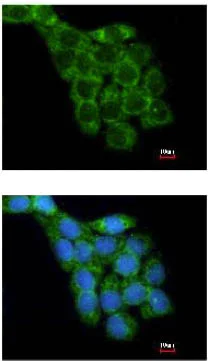 Immunocytochemistry/ Immunofluorescence - Anti-RPL8 antibody (AB155136)