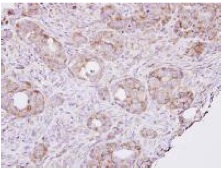 Immunohistochemistry (Formalin/PFA-fixed paraffin-embedded sections) - Anti-RPL8 antibody (AB155136)
