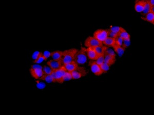 Immunocytochemistry/ Immunofluorescence - Anti-RPL8 antibody [EPR11630] (AB169538), expandable thumbnail
