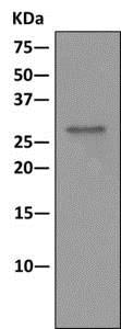 Immunoprecipitation - Anti-RPL8 antibody [EPR11630] (AB169538), expandable thumbnail