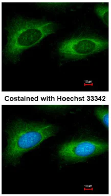 Immunocytochemistry/ Immunofluorescence - Anti-RPL9 antibody (AB102011)