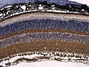 Immunohistochemistry (Formalin/PFA-fixed paraffin-embedded sections) - Anti-RPL9 antibody (AB102011)
