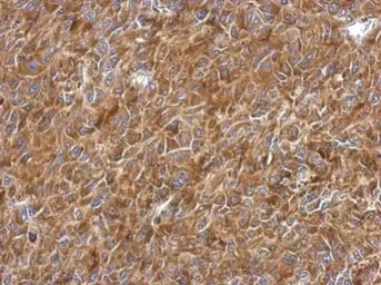 Immunohistochemistry (Formalin/PFA-fixed paraffin-embedded sections) - Anti-RPL9 antibody (AB102011)