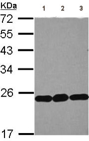 Western blot - Anti-RPL9 antibody (AB102011), expandable thumbnail