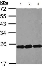 Western blot - Anti-RPL9 antibody (AB102011)