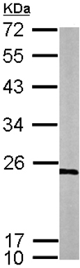 Western blot - Anti-RPL9 antibody (AB102011), expandable thumbnail